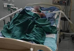 Quảng Nam: Một bệnh nhân tử vong do nhiễm 'vi khuẩn ăn thịt người'