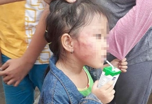 Bàng hoàng cô giáo mầm non tát thâm mặt bé gái 5 tuổi ở TP HCM