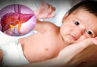 Viêm gan ở trẻ em và những điều bạn nên biết